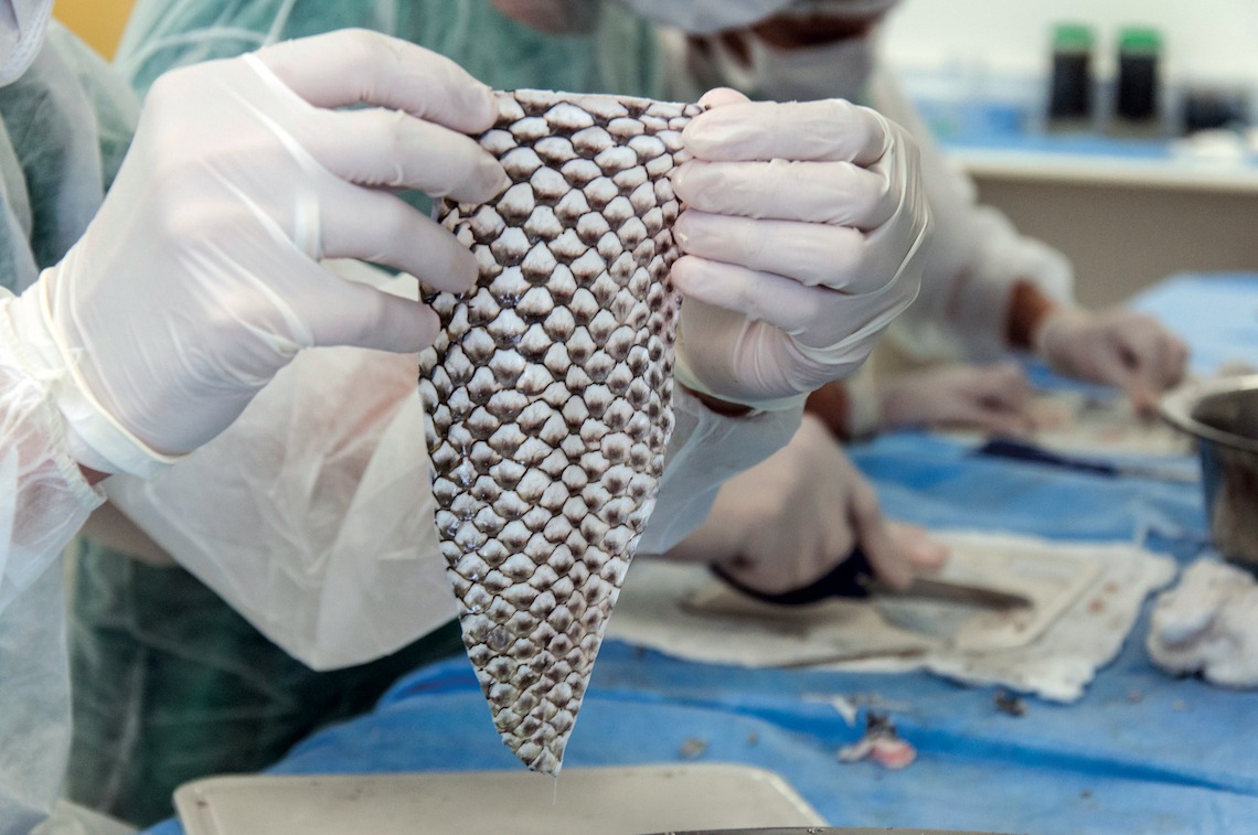 HT14. Tilapia Skin: An Innovative Alternative for Burn Recovery