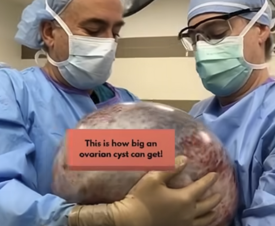 HT6. They told her she was pregnant with triplets, but the… See more