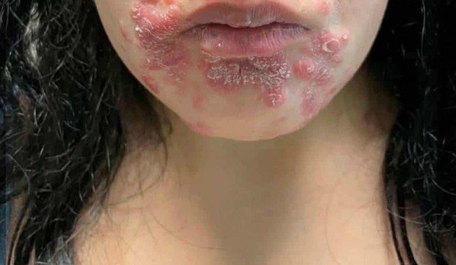 HT6. These are the consequences of sleeping co… See more