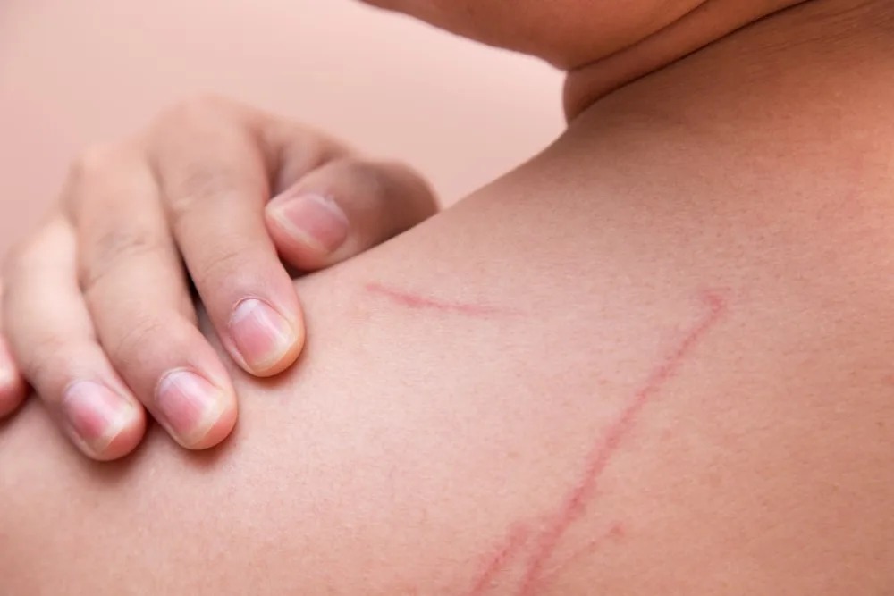 HT1. These are the consequences of sleeping with…