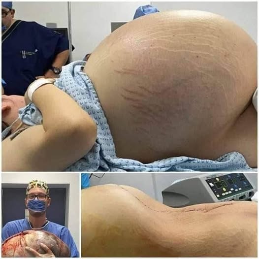 HT14. They told her she was pregnant with triplets, but the… See more