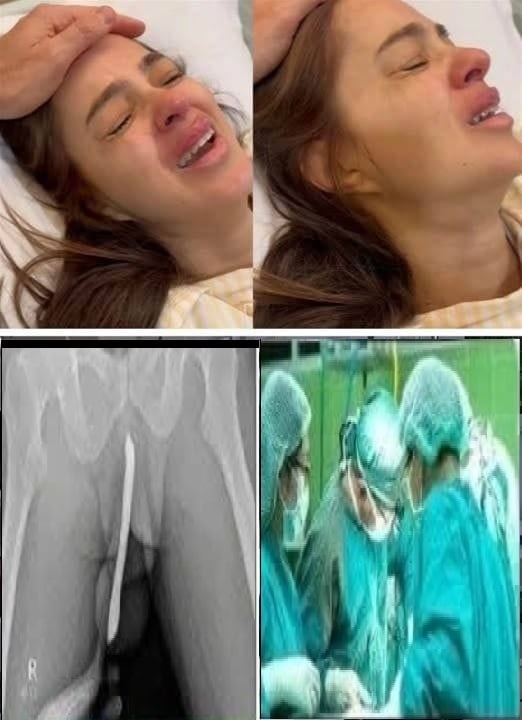 HT6. Girl had to be hospitalized for wanting to use a pe…See more