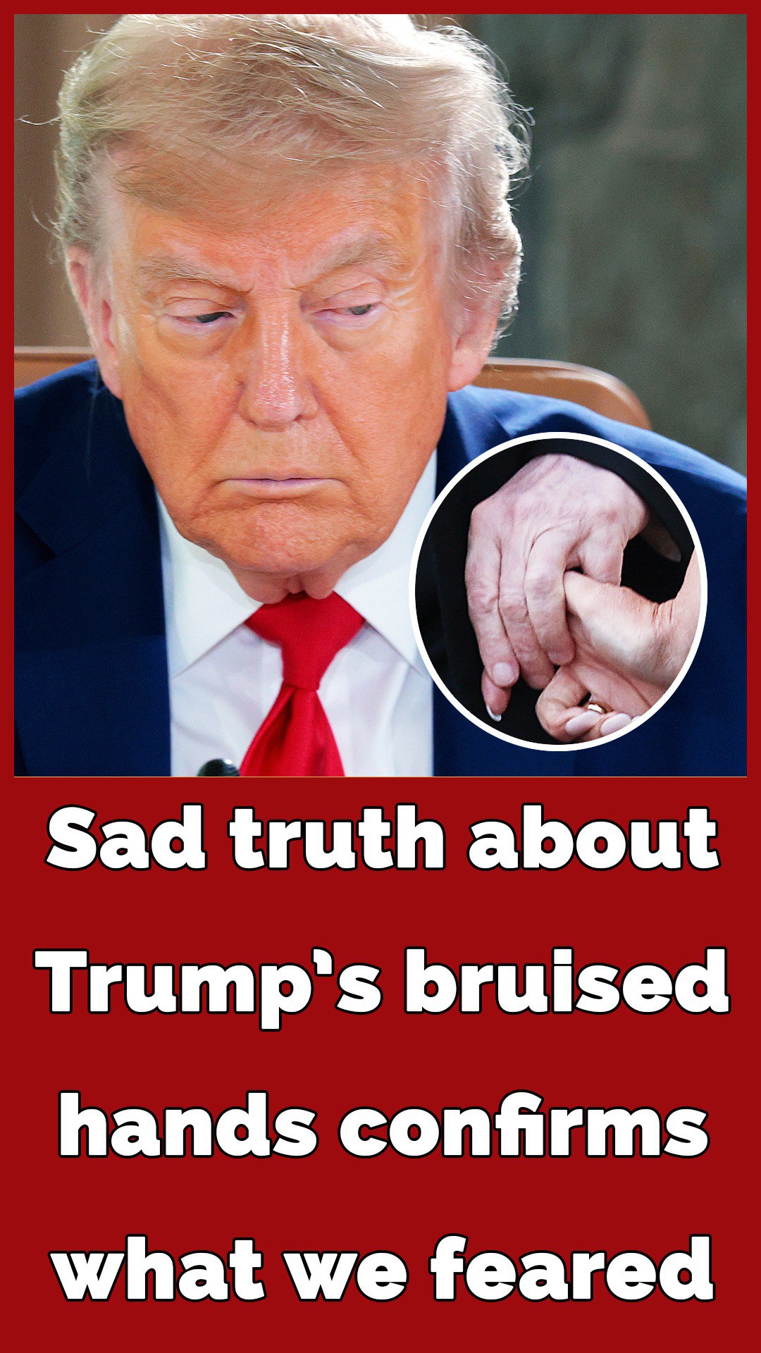 ST7. Trump shows off ‘wrinkled hands’ amid latest health fear