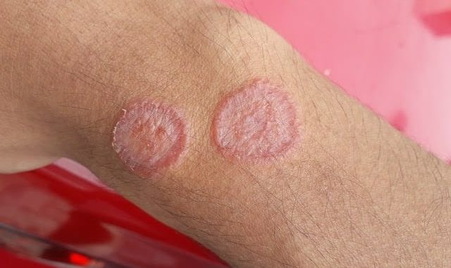 HT6. These are the signs that he is cr…