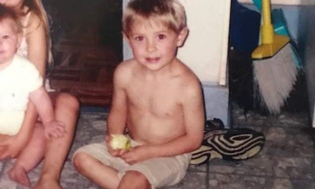 ST1. Burned at Four, Rebuilt by Medicine: The Long Road of a Child Who Refused to Disappear