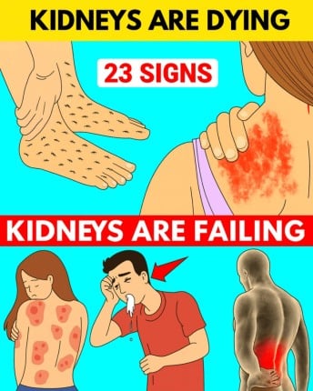 HT14. 23 Strange Signs Your Kidneys Might Be in Trouble