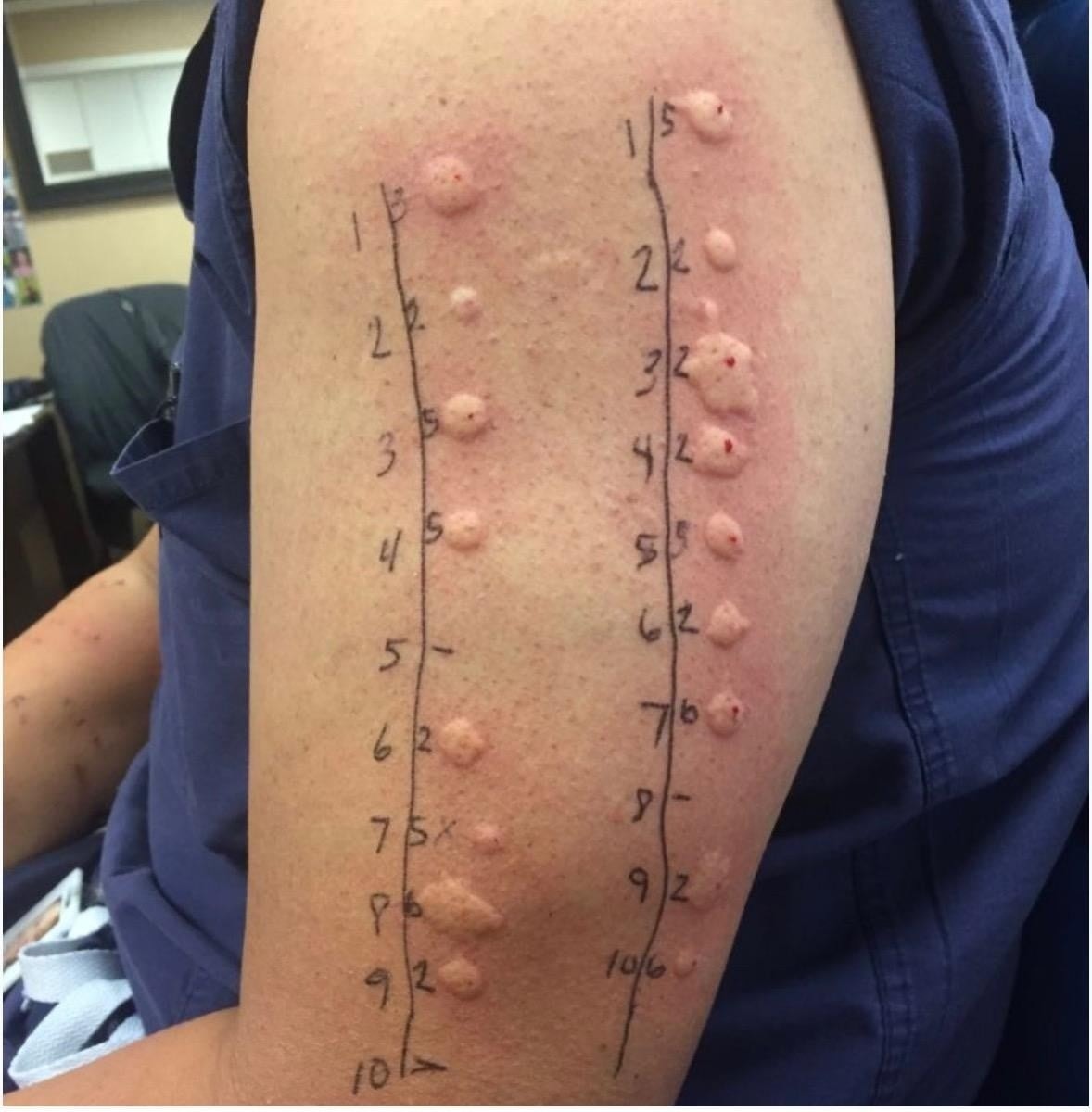 HT7. These are the consequences of sleeping with the… See more