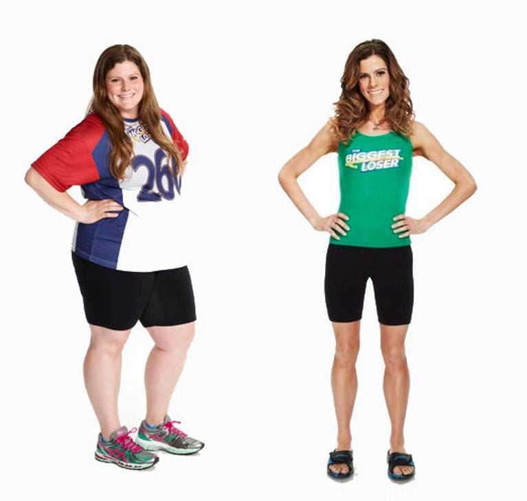 ST14. When a Photo Says Too Much: The Real Story Behind Extreme Weight Loss, Recovery, and the Pressure to Look “Perfect”