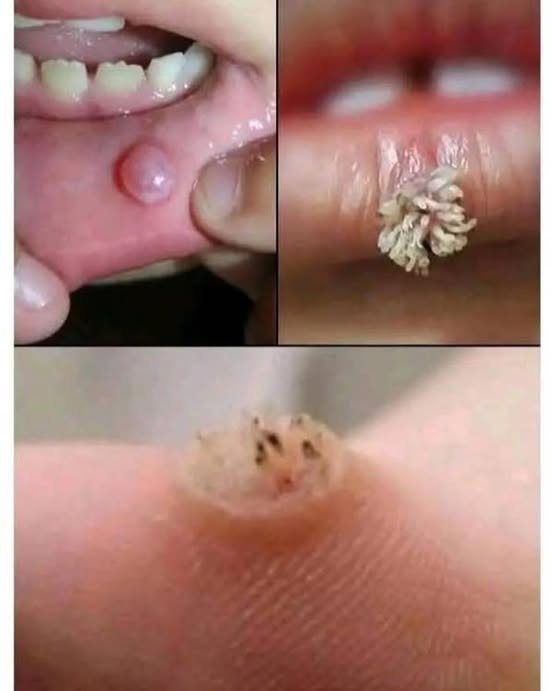 HT6. Be very careful if it comes out in your mouth, you are infected with…See more