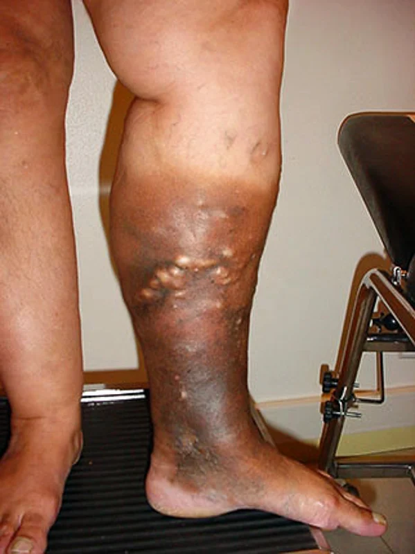 HT10. These are the first symptoms of a… See more