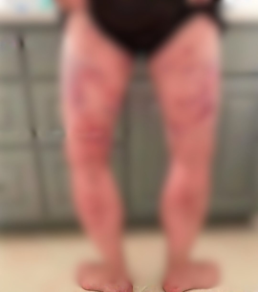 HT7. These are the consequences of sleeping with the… See more