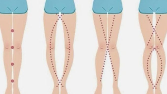 HT14. THE LEGS OF A WOMAN CAN SAY AS IT IS THEIR V*GlN