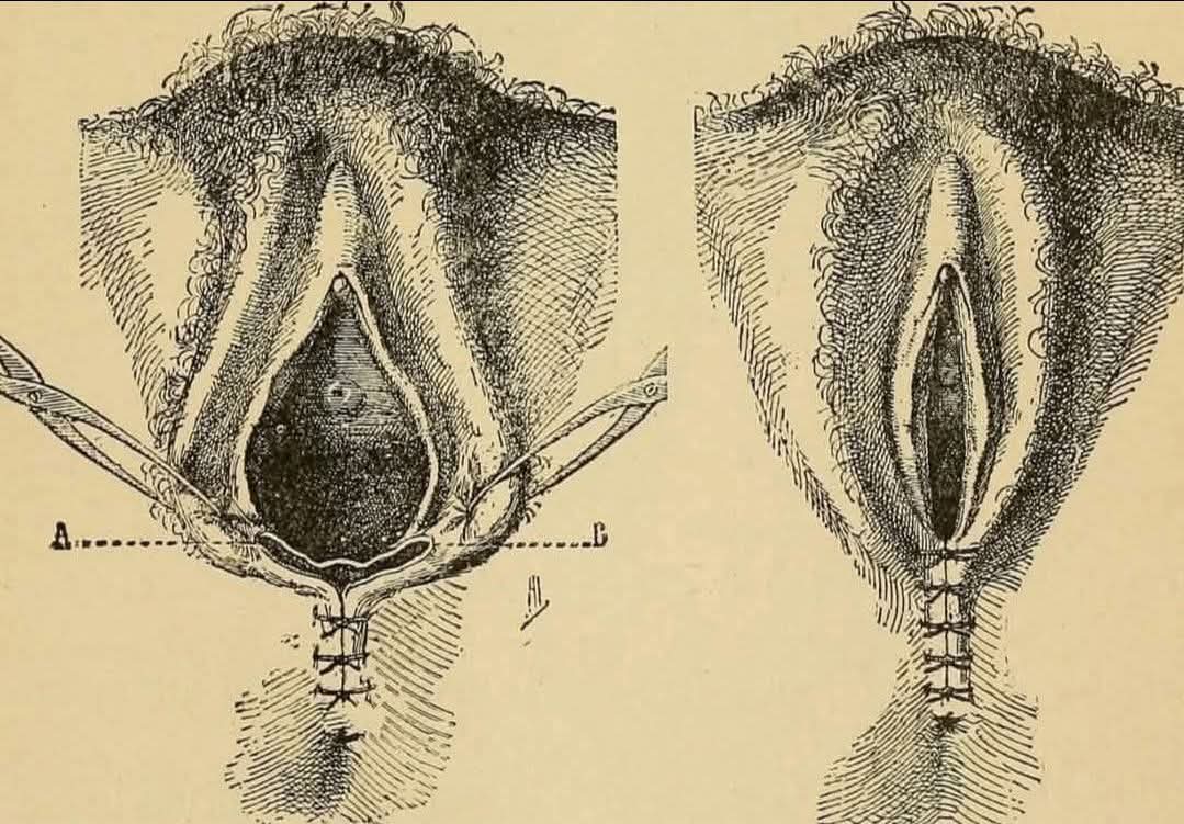 HT6. Enital hygiene our tips … See more