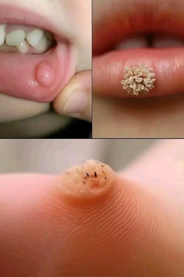 HT14. These are the first signs of an enf…See more