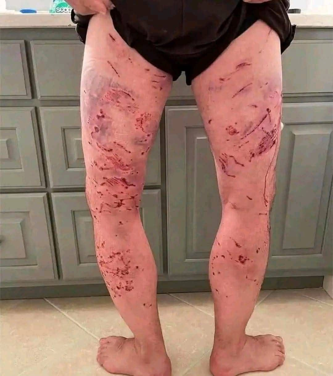 HT7. These are the consequences of sleeping with the… See more