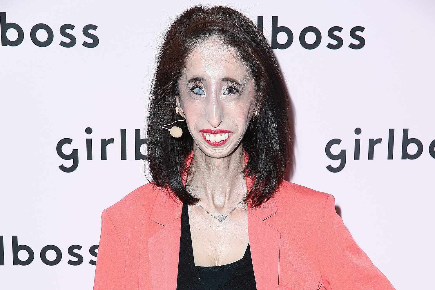 ST1. Turning Cruelty Into Courage and Inspiring Millions