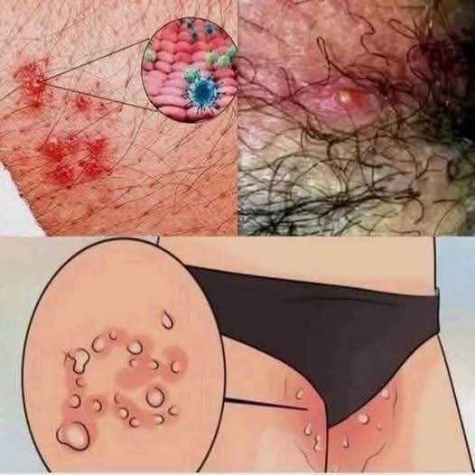 HT7. These are the signs that he is cr… See more