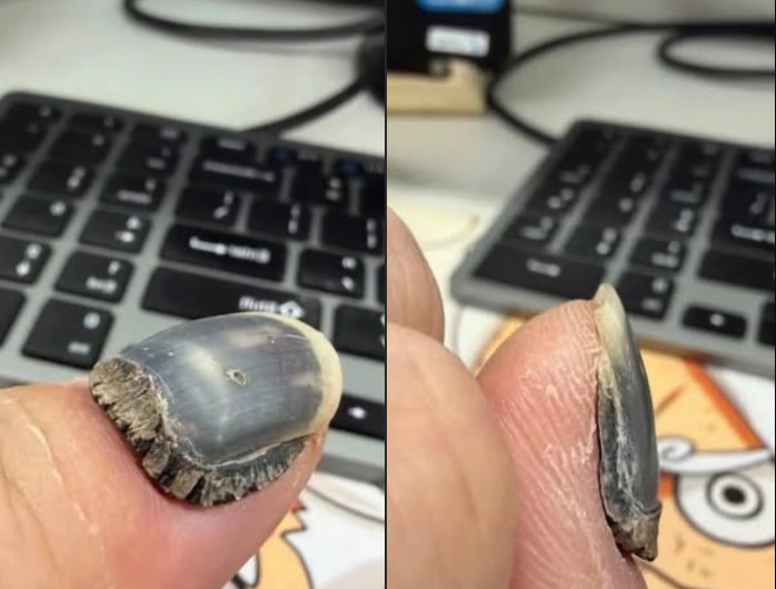 HT14. These are the consequences of using too much n… See more