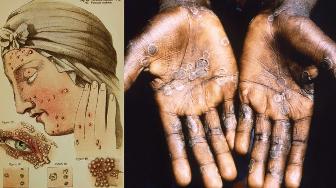 ST1. The Scariest Diseases in Human History: When Illness Reshaped Civilization
