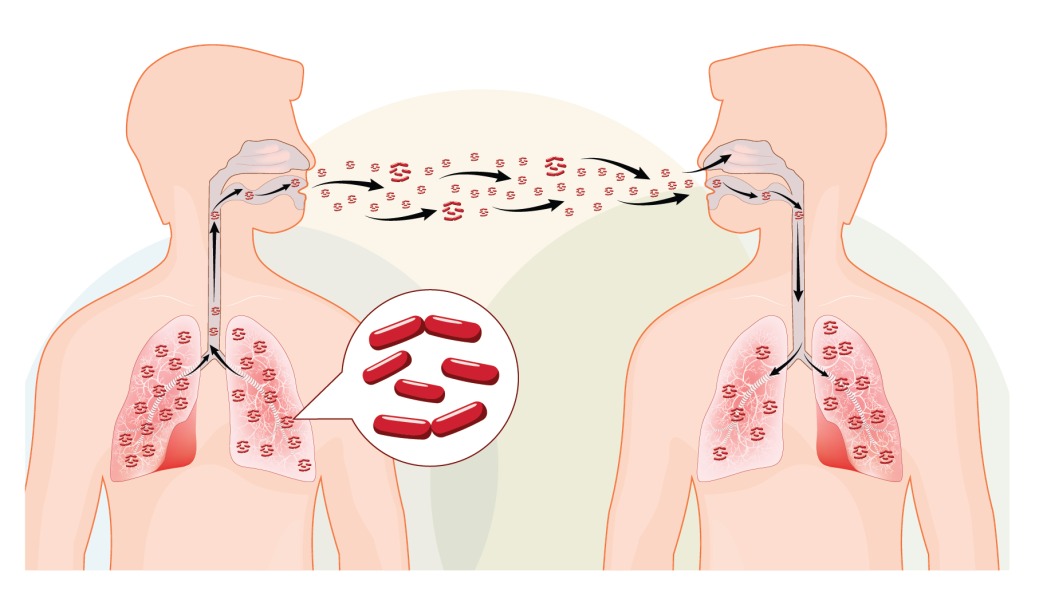 ST14. 10 Most Dangerous Diseases in Today’s Society