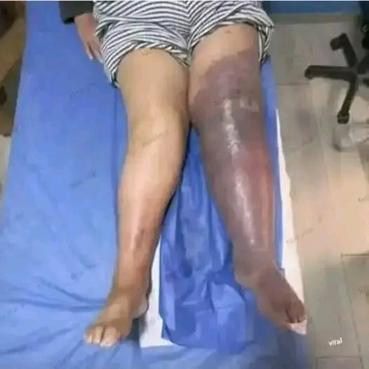 HT14. These are the consequences of sleeping with a… See more