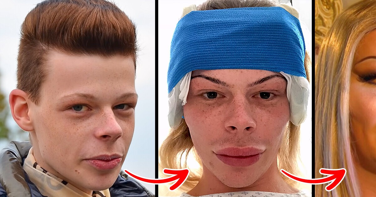 ST14. He paid $73.000 for surgeries to look like a woman…