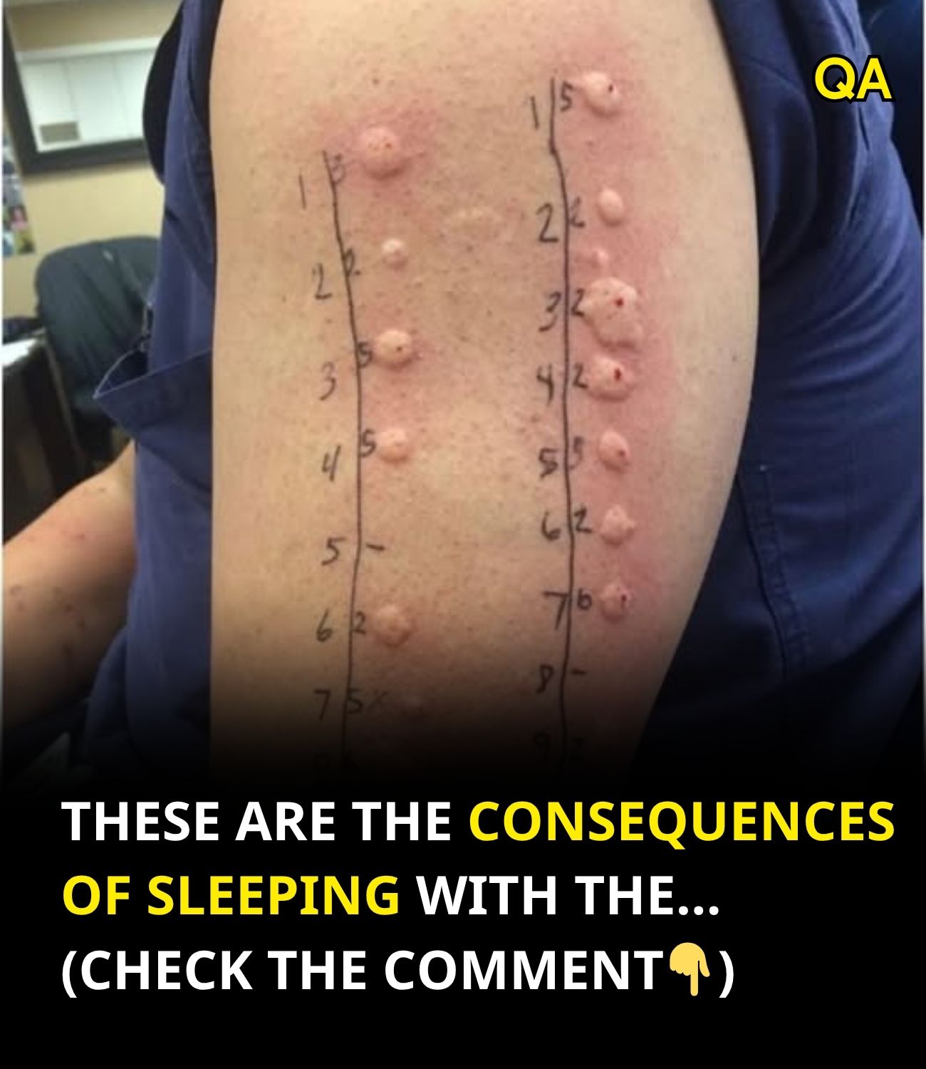 HT1. These are the consequences of sleeping with the… See more