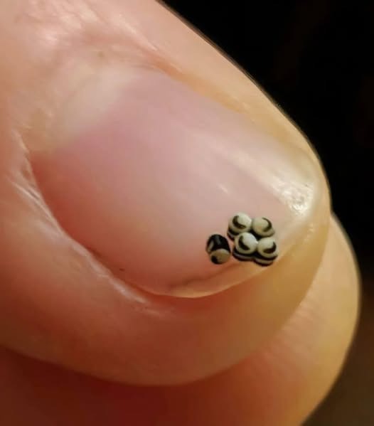 HT6. We ordered a salad, but there were tiny black specks in the food – we went straight to the hospital