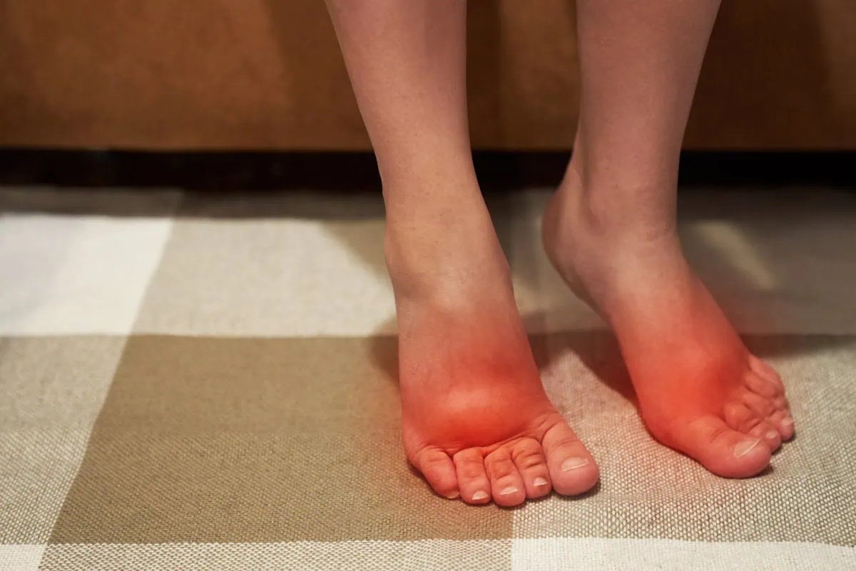 HT1. The 5 Best Nutrients to Reduce Swelling in the Feet and Legs