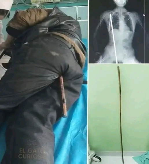 HT1. Young man hospitalized after being arrested…See more