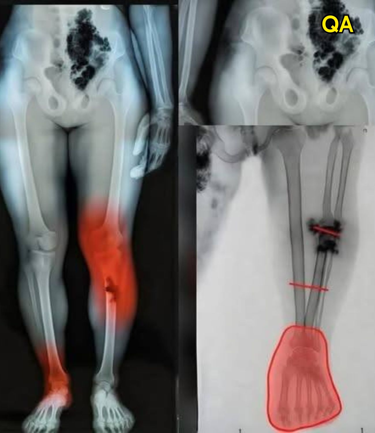 HT14. COVID-19 vaccinated individuals may be ill…See more