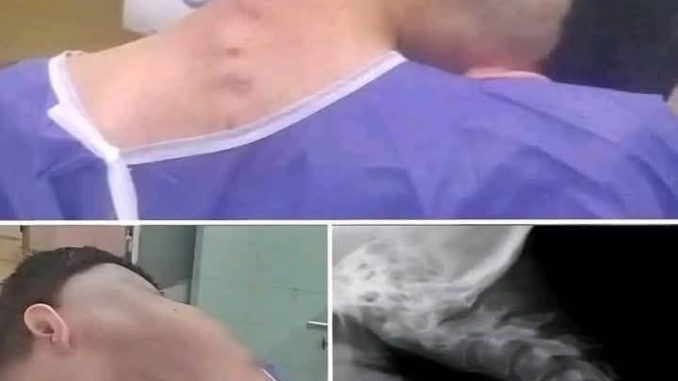 HT6. Young man hospitalized because he dropped his ca…See more