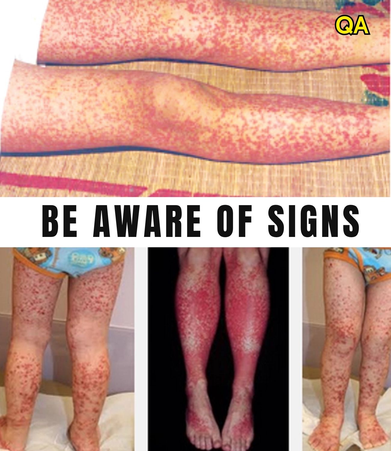 HT6. These are the consequences of sleeping with many…