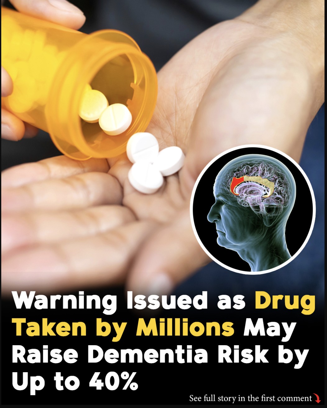 HT7. Common back-pain drug may be linked to higher dementia risk, large study finds