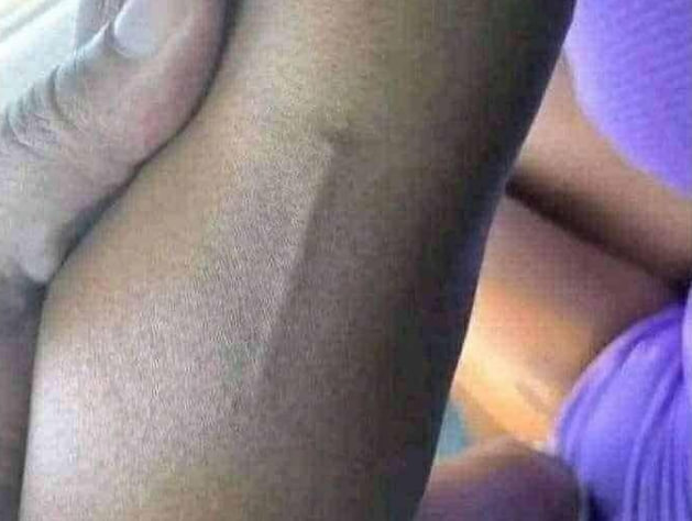 HT1. Found this in my girls arm still trying to figure out what it is