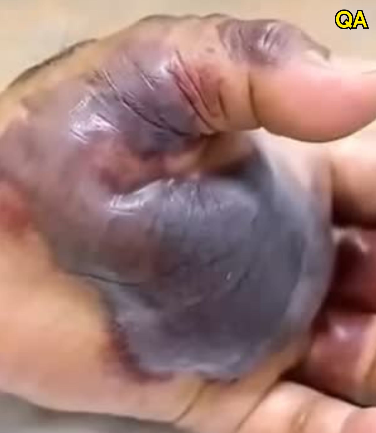 HT1. ATTENTION to these first signs of…See More