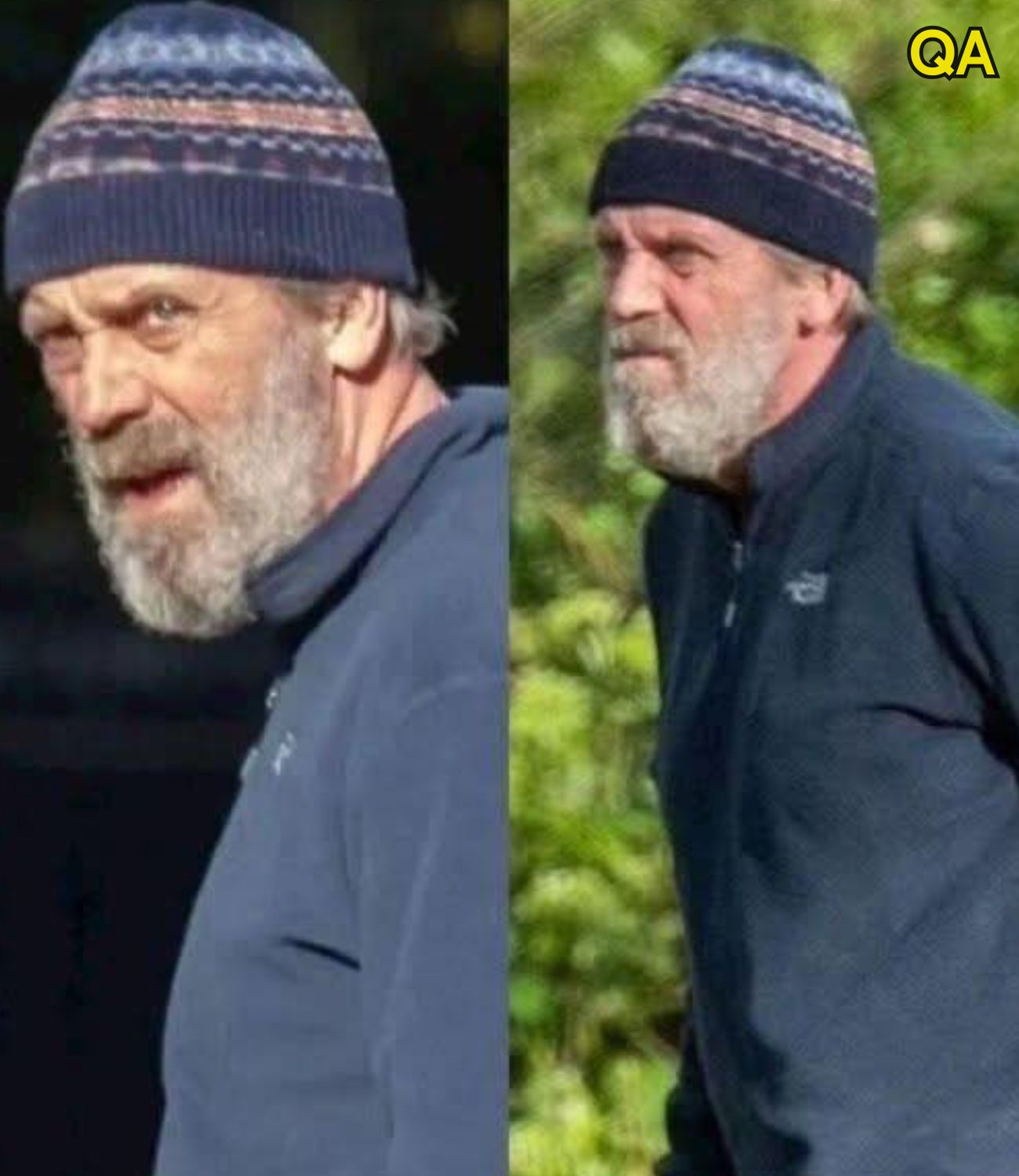 HT10. At 62, Hugh Laurie Looks Unrecognizable: What’s Changed?