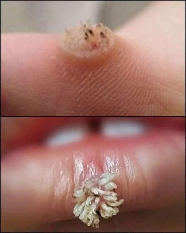 HT7. These are the consequences of wearing used!