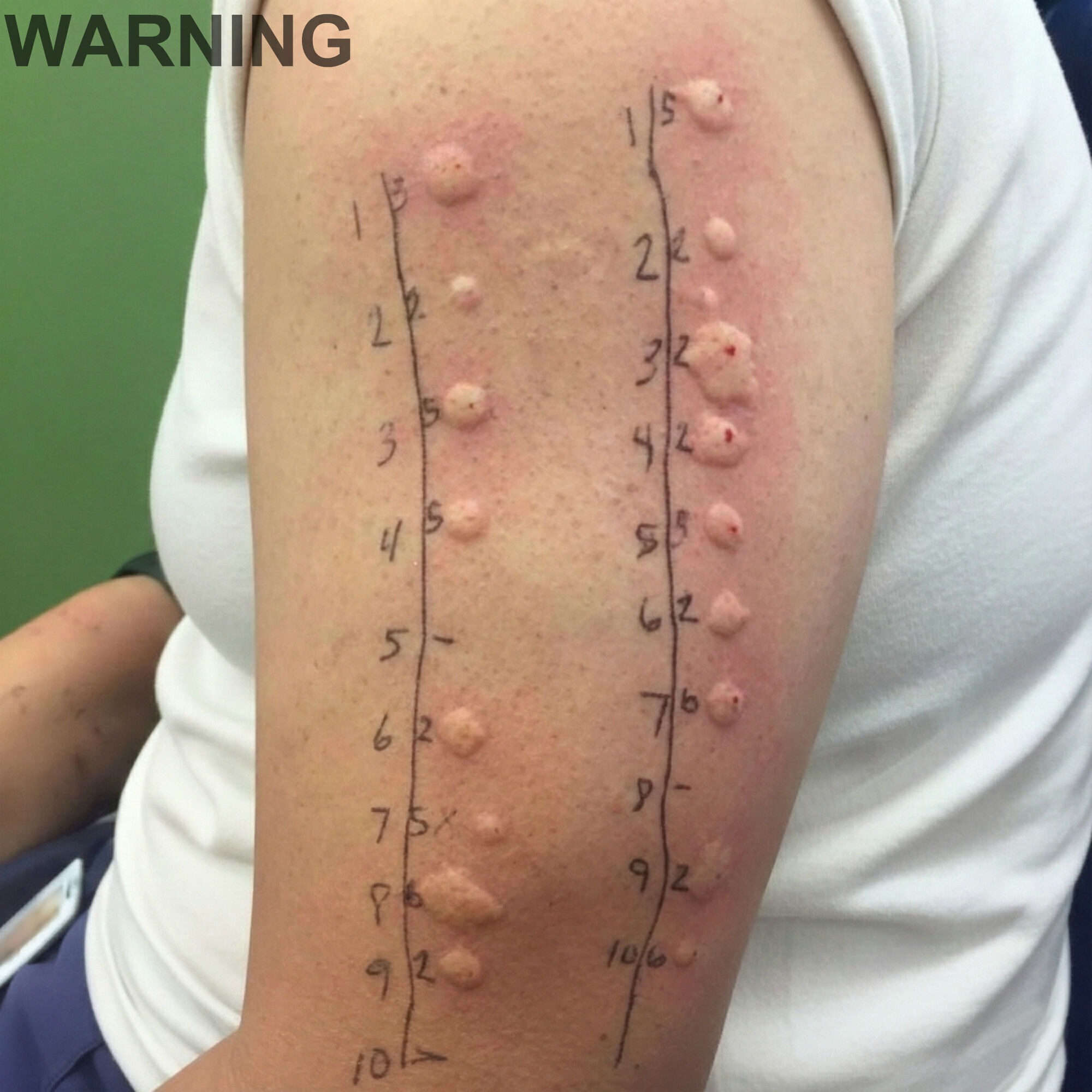 HT1. These are the consequences of sleeping with the… See more