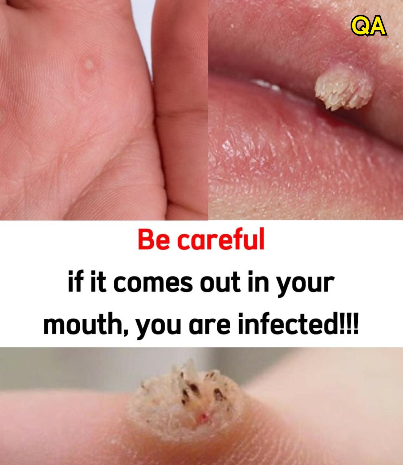 HT1. These are the first signs of an enf…See more…