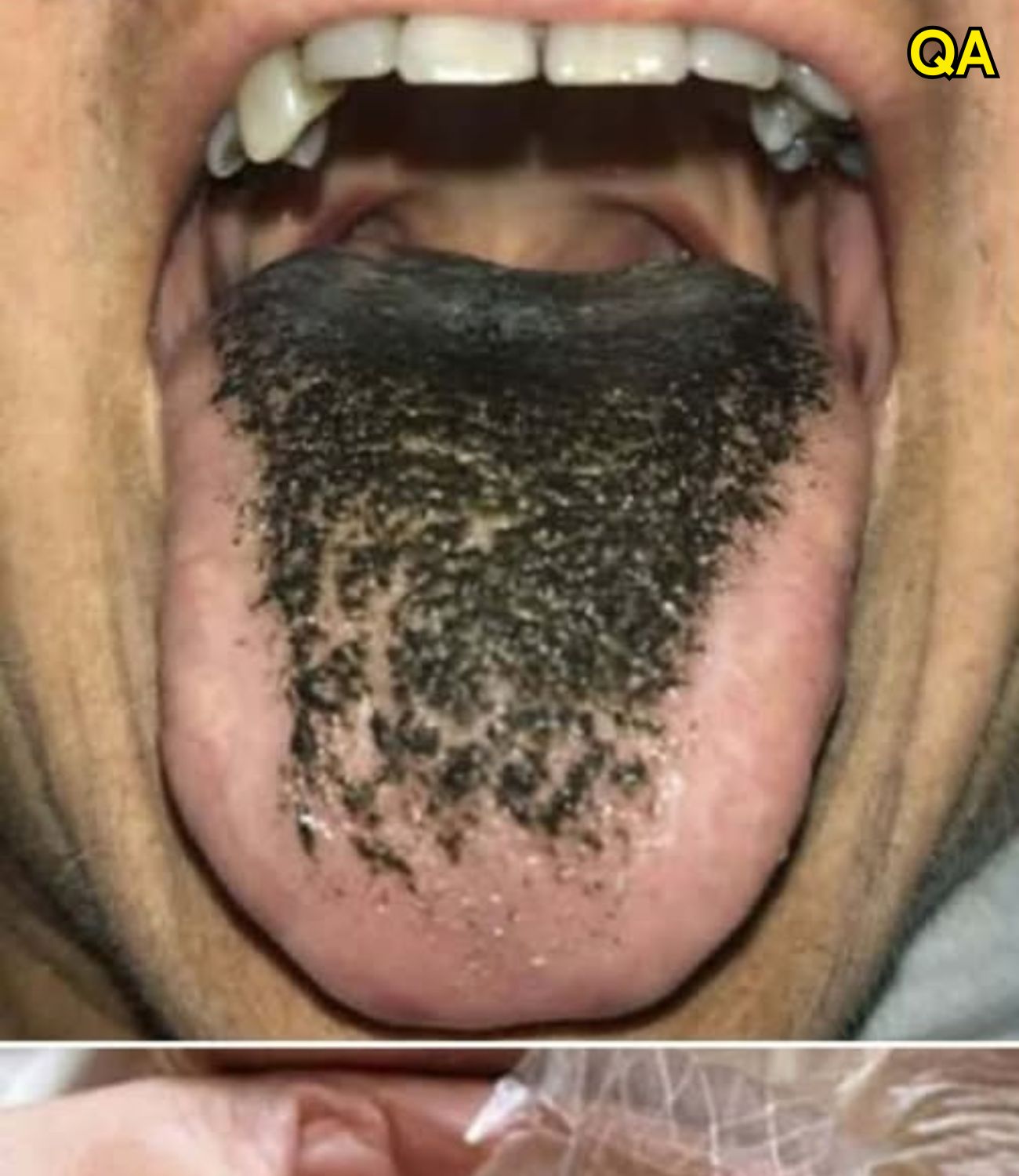 HT1. These are the consequences of sleeping with the…See more