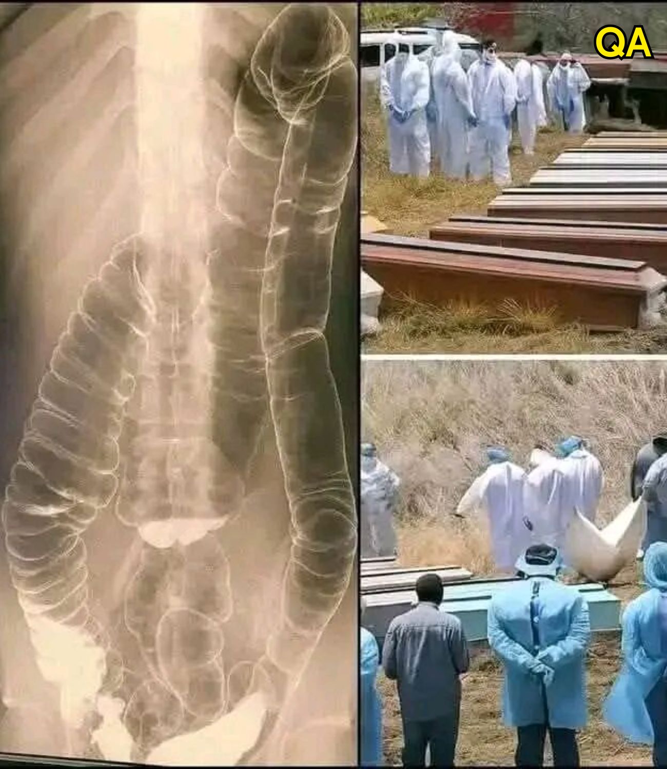 HT6. Worldwide alert to the vaccinated…See more