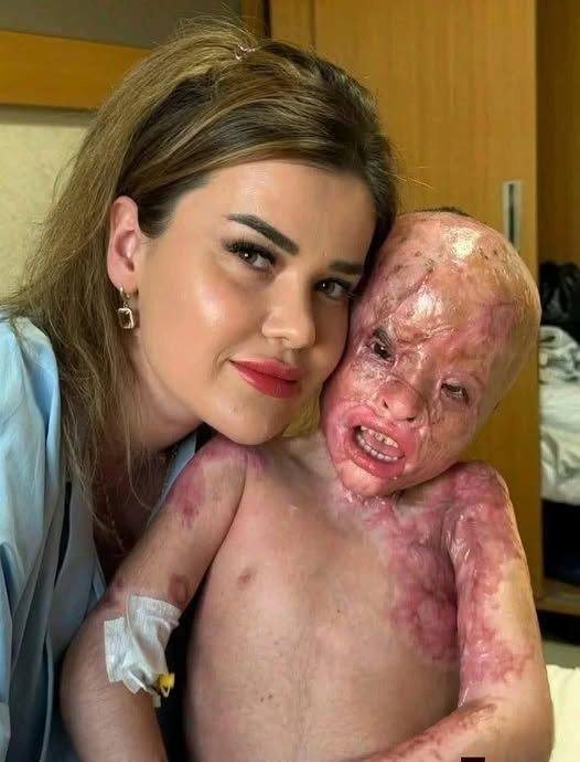 HT14. Juan Miguel, the boy who survived, says GOODBYE…See more