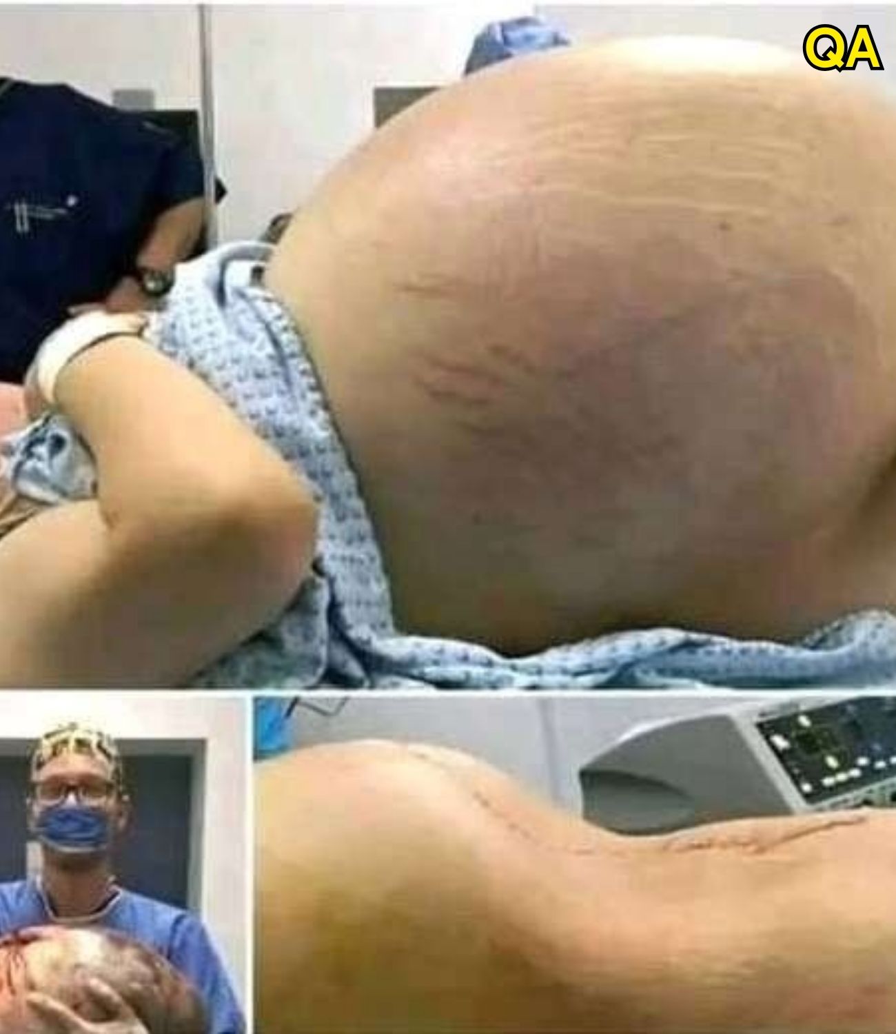 HT1. She went into labor, and you won’t believe what they took out of her wo…See more