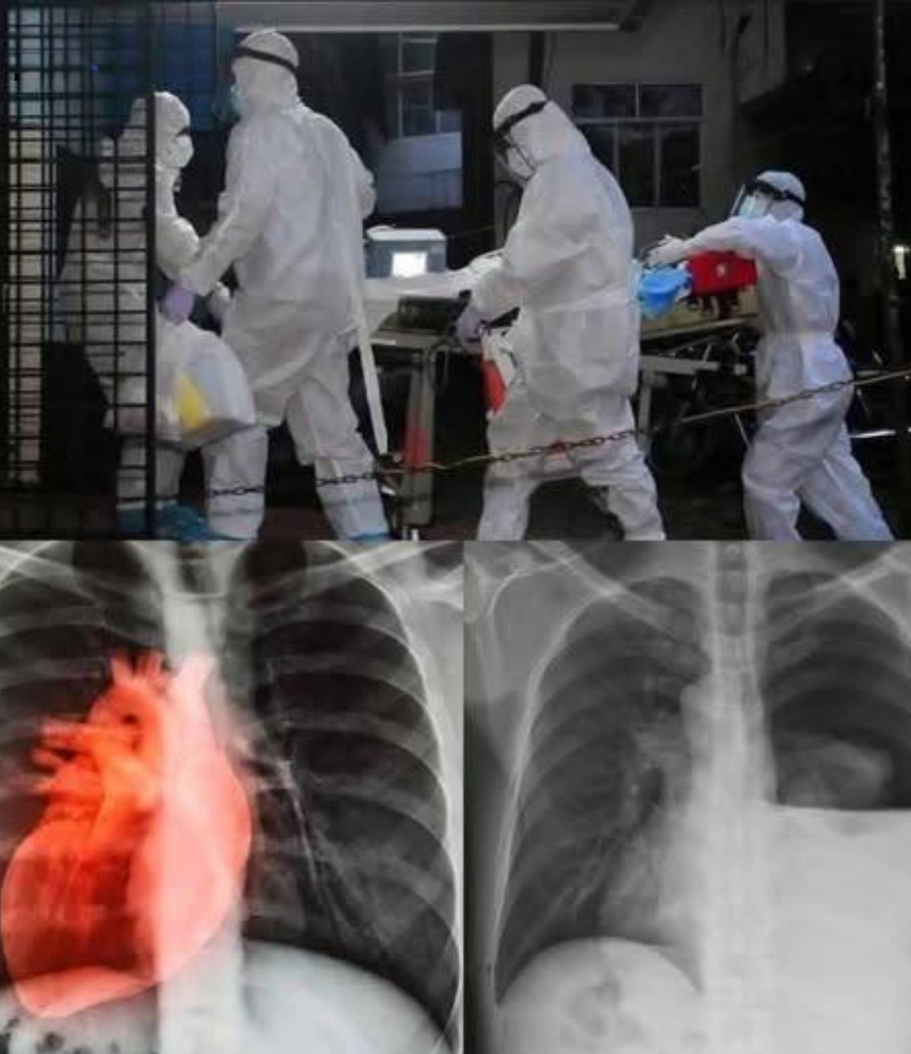 HT6. Understanding the Latest Updates on COVID-19 Vaccination Research-