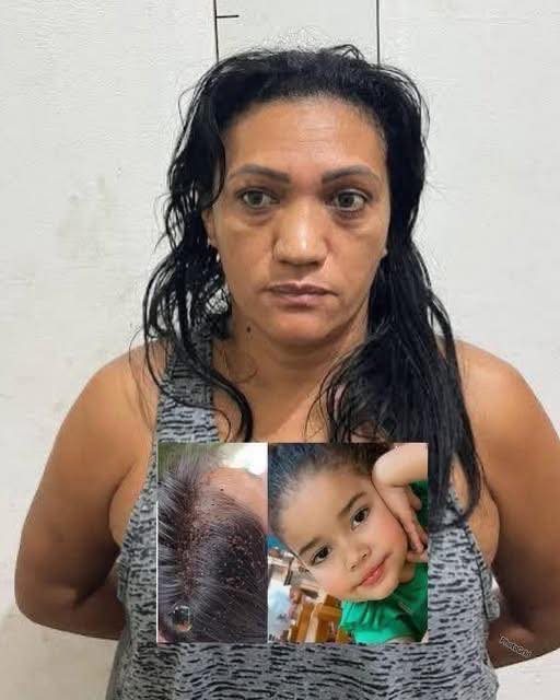 HT14. 3-year-old girl d!es after lice a!tack and mother warns… See more