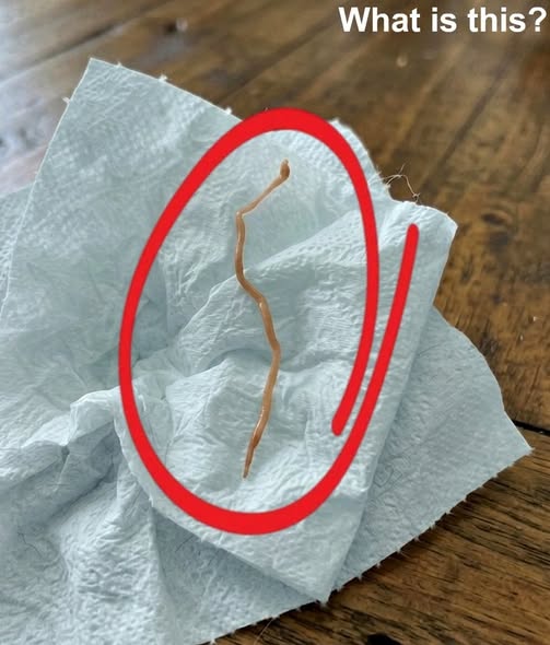 HT7. I FOUND A WRITHING PARASITE IN MY DINNER AND ALMOST VOMITED UNTIL I LOOKED CLOSER