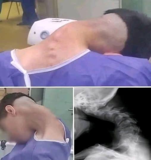 HT6. HIS HEAD SUDDENLY DROPPED AND HE COULD NOT LIFT IT BACK UP THE TERRIFYING TRUTH ABOUT THE SMARTPHONE SYNDROME RUINING YOUNG LIVES