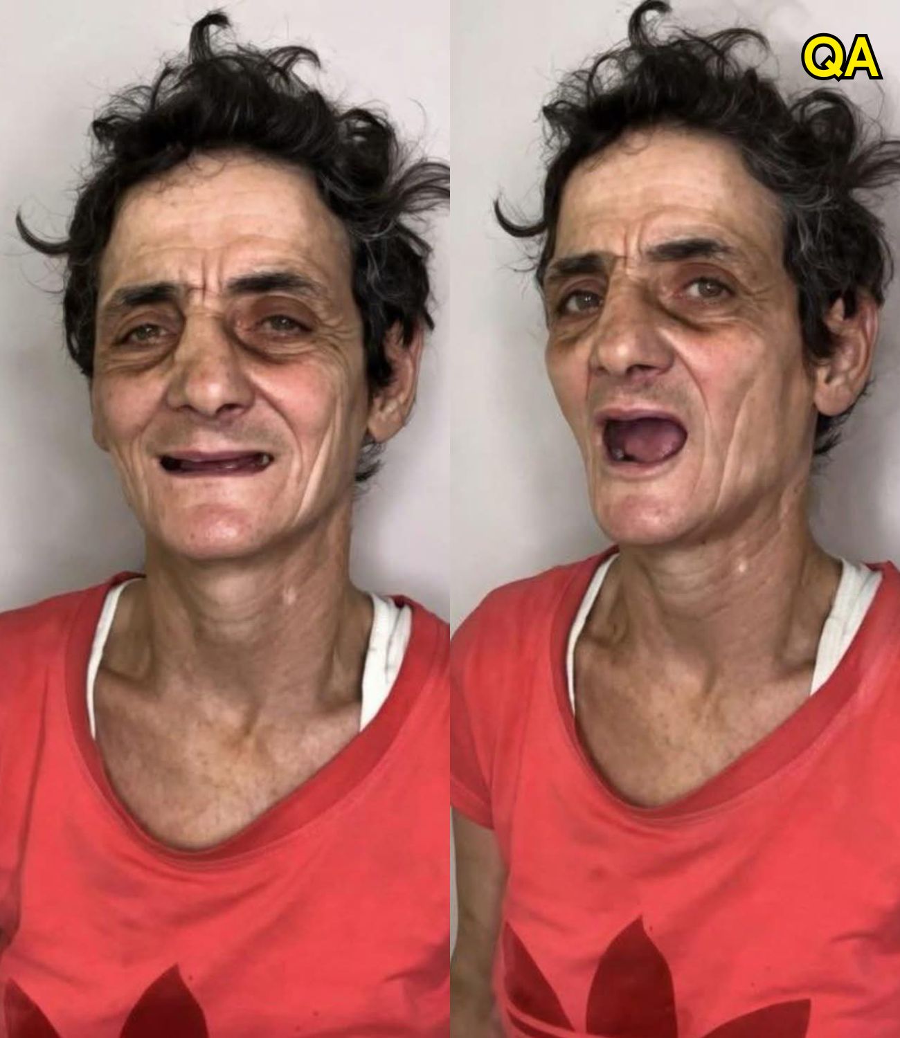 HT1. This woman spent years living