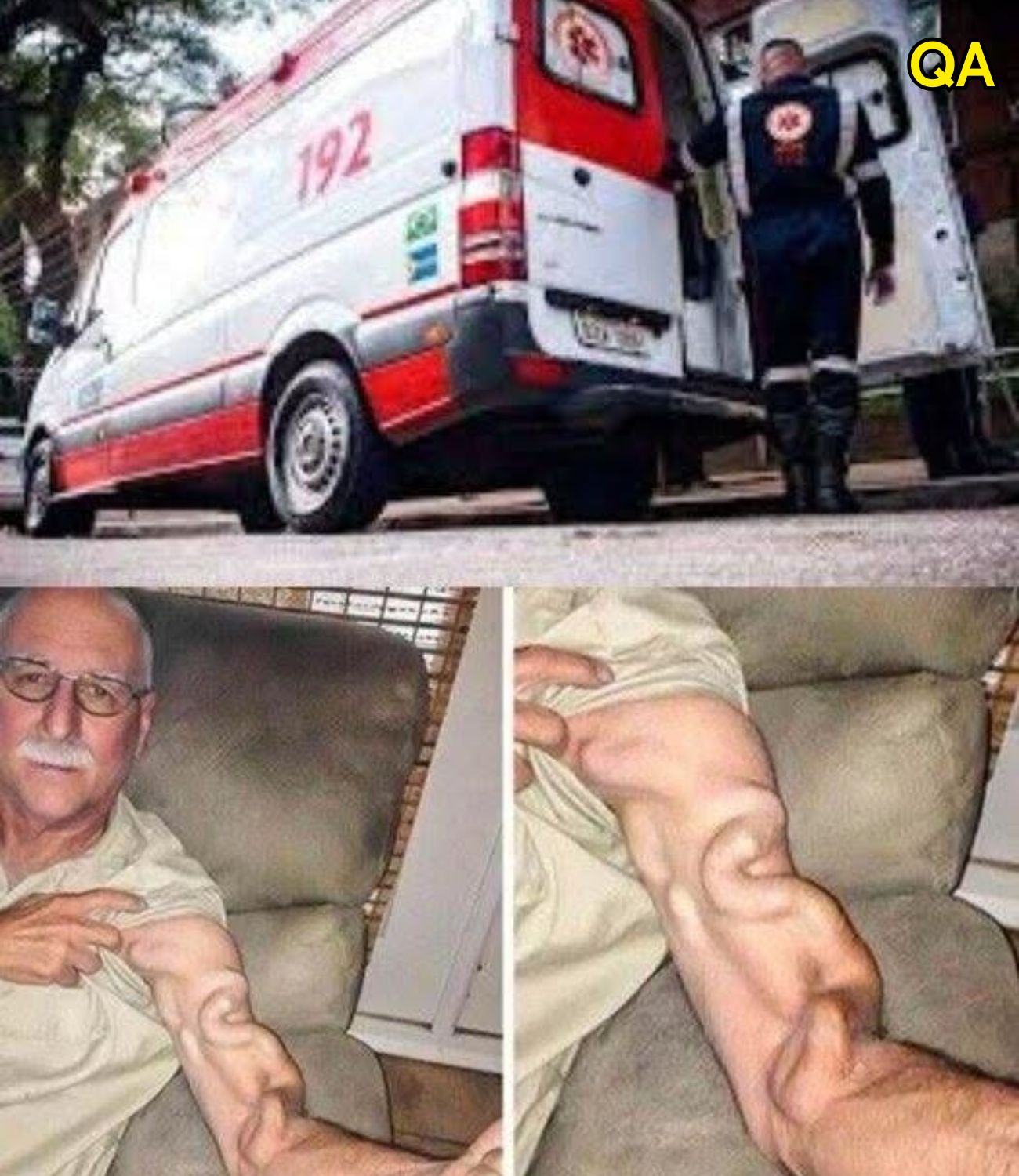HT14. A man goes to stretch and ends up feeling a sharp pain in his arm, it was a ca… See more